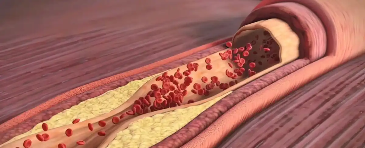 Hirudin Natural.jpg Hirudin Natural.jpg